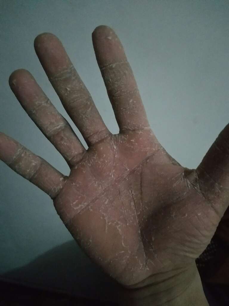 那个老是说搬砖的!出来看看这才是真正的搬砖的手